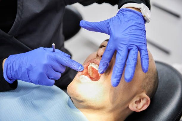 Best Emergency Treatment for Dental Infections or Abscesses in Coachella, CA