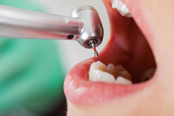 Best Pediatric Emergency Dentist in Coachella, CA
